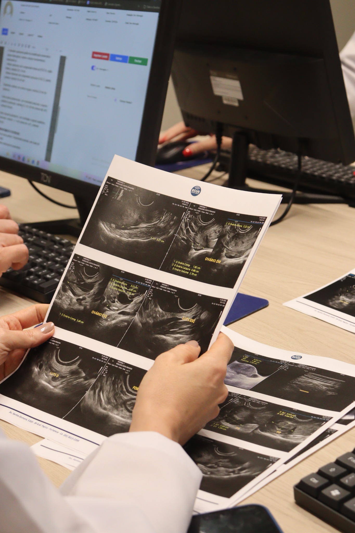 Laudos e imagens de ultrassonografia impressas durante discussão de casos